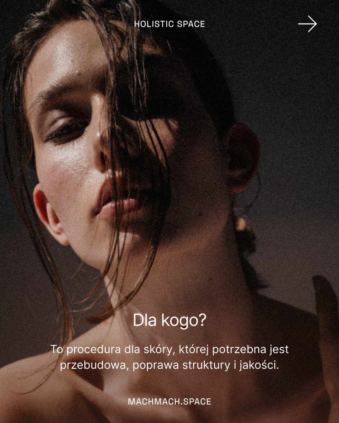 Mezoterapia mikroigłowa (Dermapen 4.0)