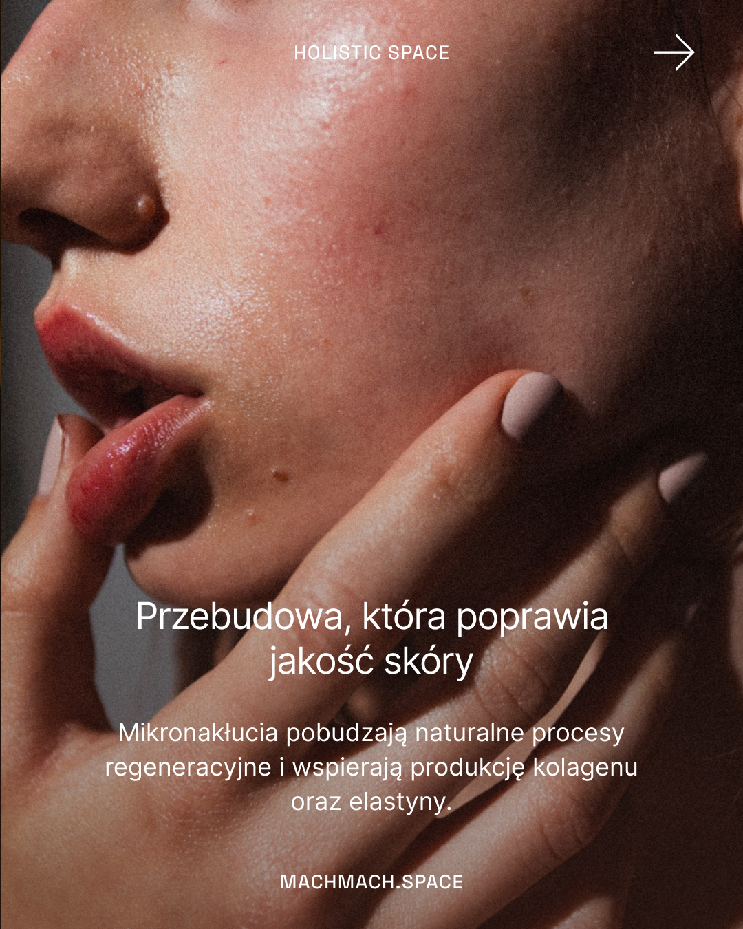 Mezoterapia mikroigłowa (Dermapen 4.0)